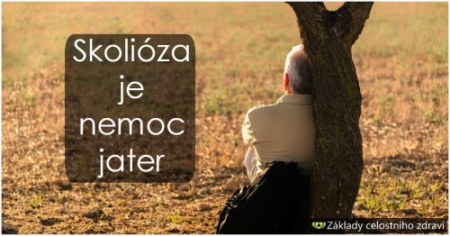 Skolióza – pomoci si musím sám